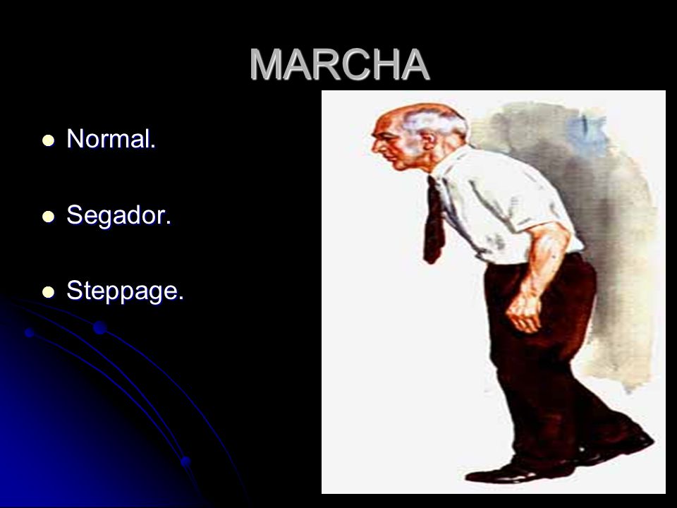marcha atrás muscular marcha atrás muscular